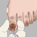修脚大师模拟器下载安装 修脚大师模拟器下载安装