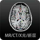 影像解剖图谱电子版 影像解剖图谱电子版